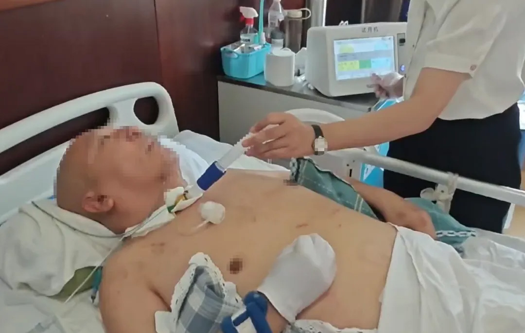 闰凯医疗无创咳痰机